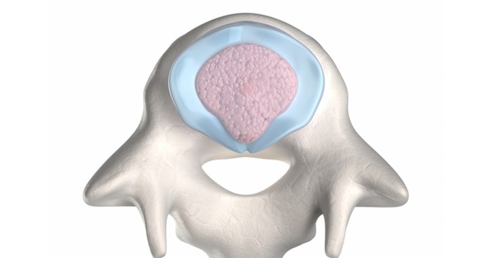 Arthroscopy osteoarthritis arthroscopic orthopedic orthopaedic kumbakonam centres procedure suffering debridement arthro